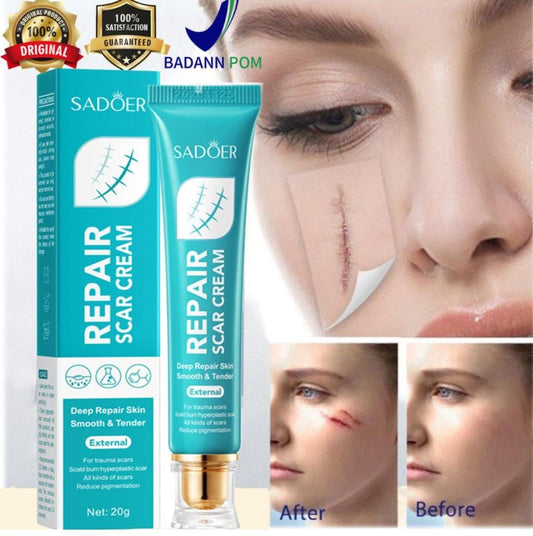 🌟CREMA REPARADORA DE CICATRICES - SADOER🌟